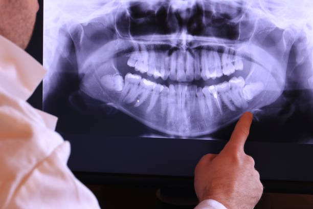 Best Urgent Care for Lost Fillings or Crowns in Silver Lake, NJ